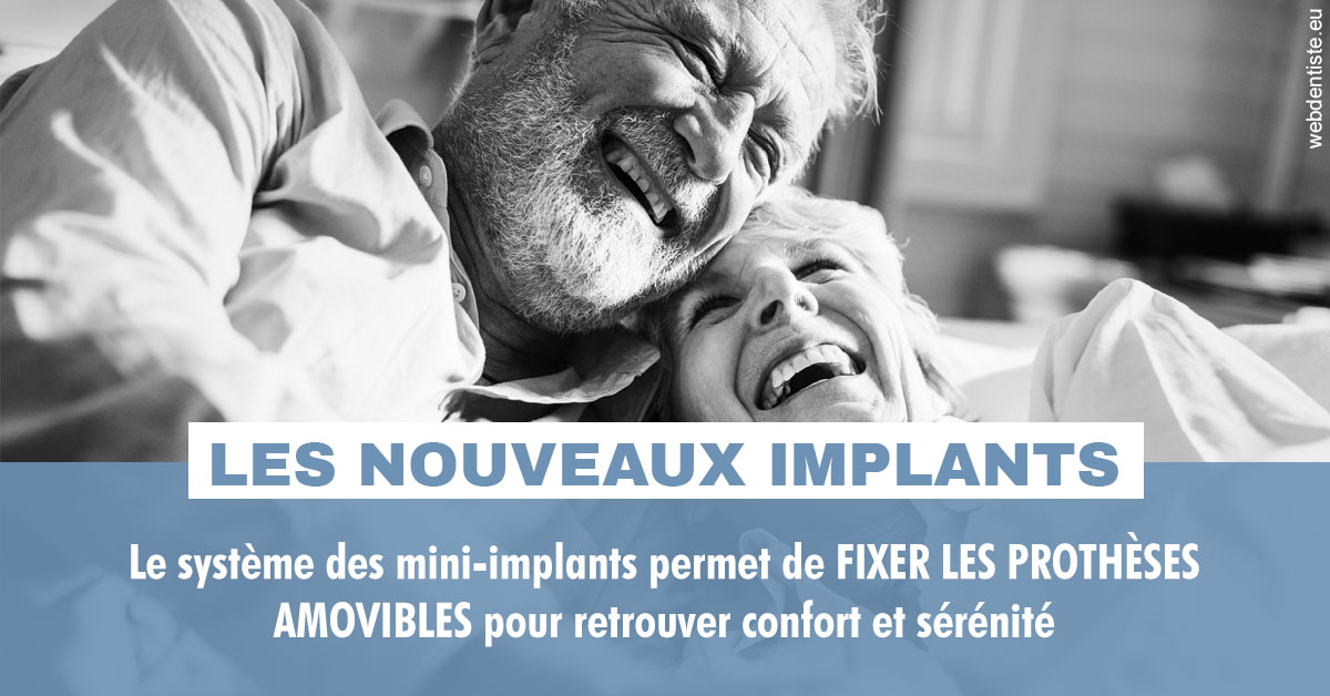 https://www.orthodontiste-vaud-geneve.ch/Les nouveaux implants 2