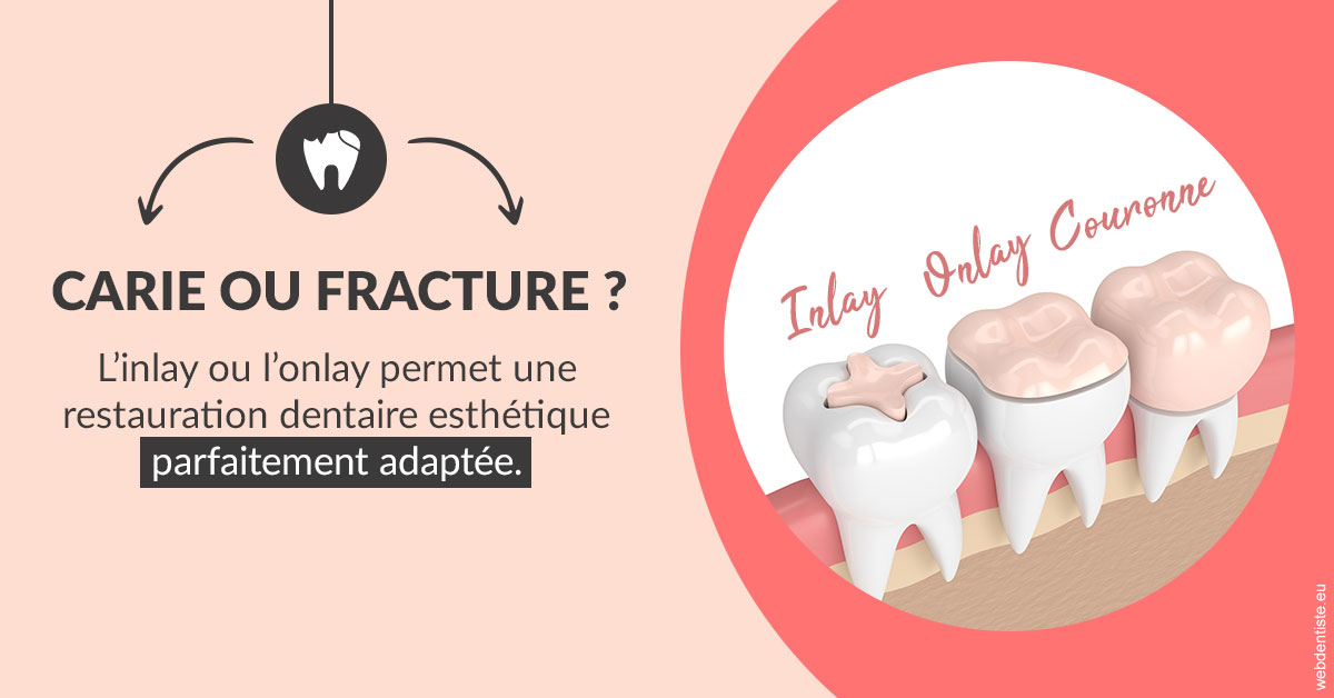 https://www.orthodontiste-vaud-geneve.ch/T2 2023 - Carie ou fracture 2