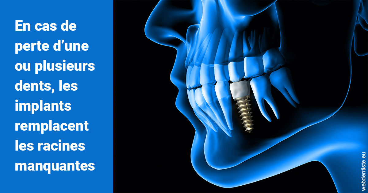 https://www.orthodontiste-vaud-geneve.ch/Les implants 1