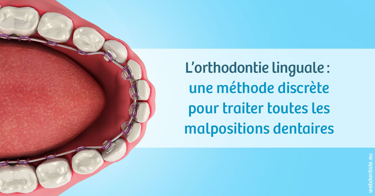 https://www.orthodontiste-vaud-geneve.ch/L'orthodontie linguale 1