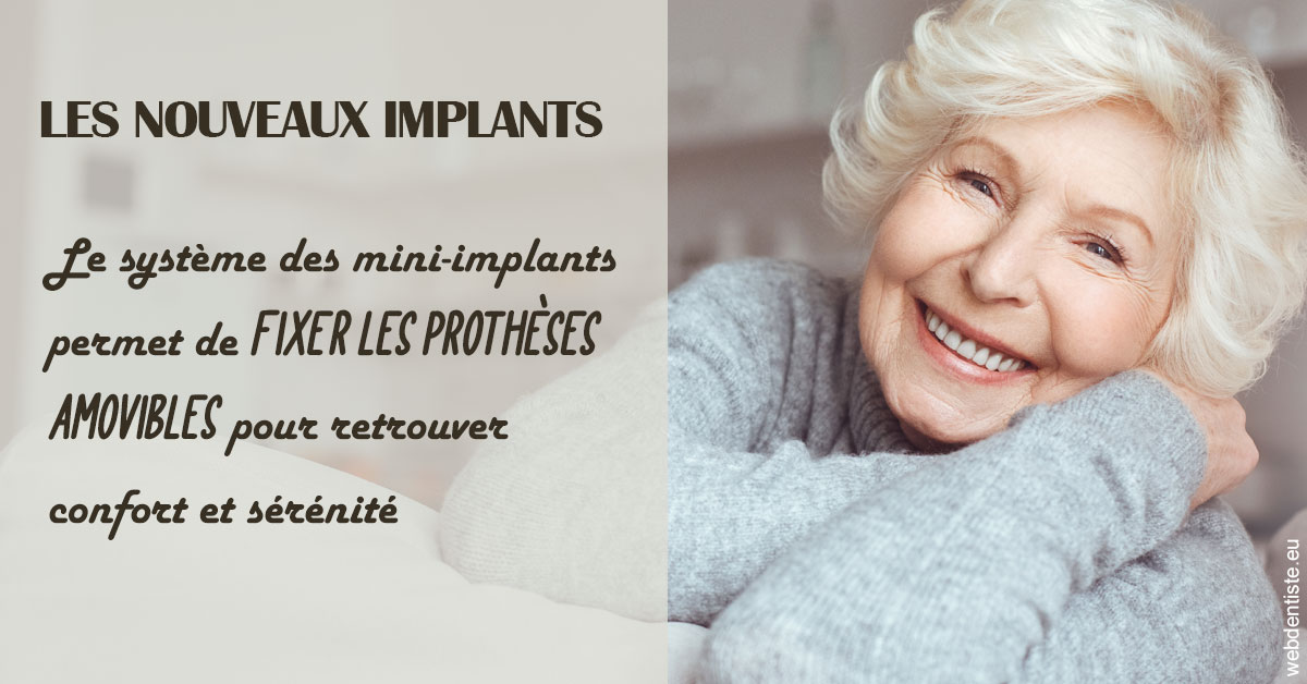 https://www.orthodontiste-vaud-geneve.ch/Les nouveaux implants 1