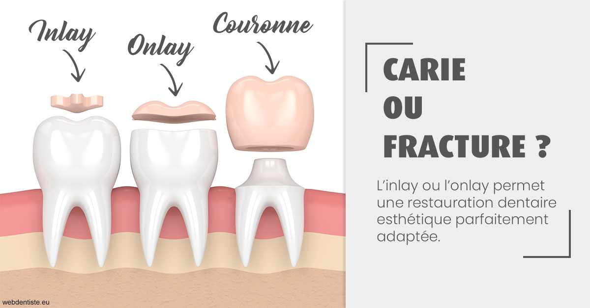 https://www.orthodontiste-vaud-geneve.ch/T2 2023 - Carie ou fracture 1