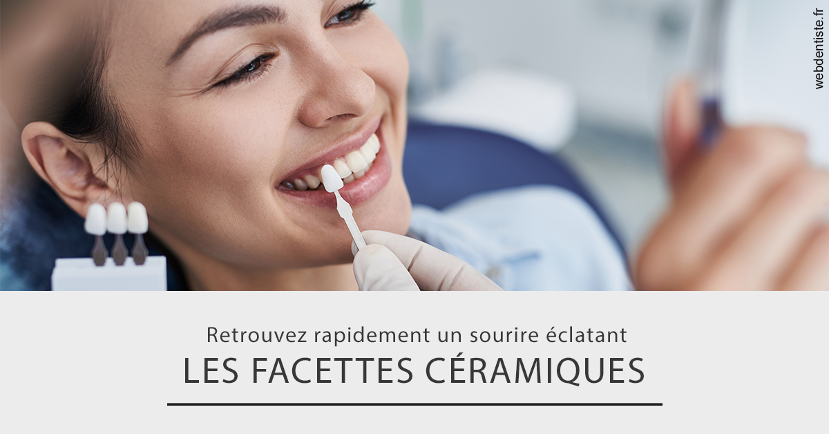 https://www.orthodontiste-vaud-geneve.ch/Les facettes céramiques 2