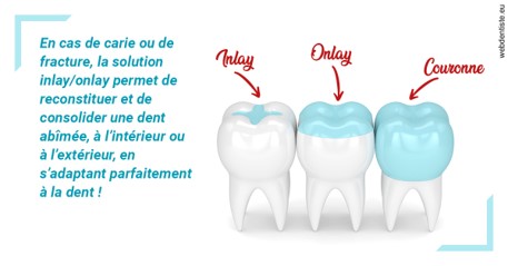 https://www.orthodontiste-vaud-geneve.ch/L'INLAY ou l'ONLAY