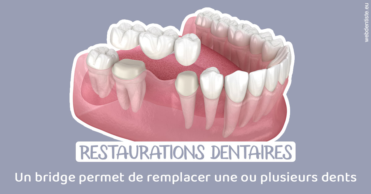 https://www.orthodontiste-vaud-geneve.ch/Bridge remplacer dents 1