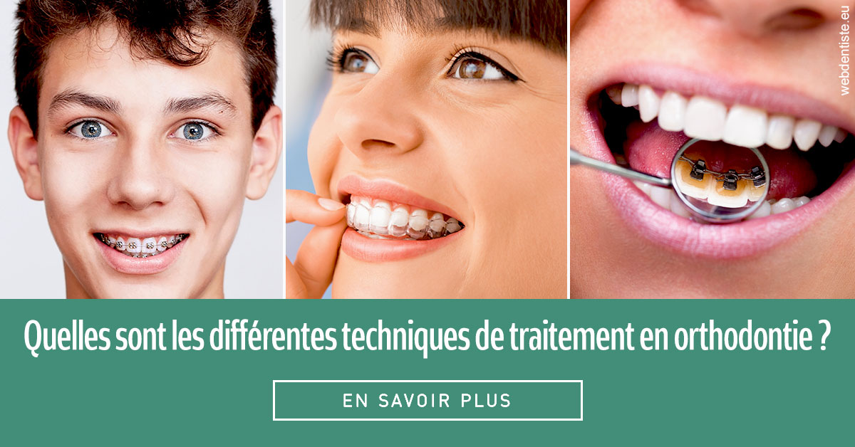 https://www.orthodontiste-vaud-geneve.ch/Les différentes techniques de traitement 2