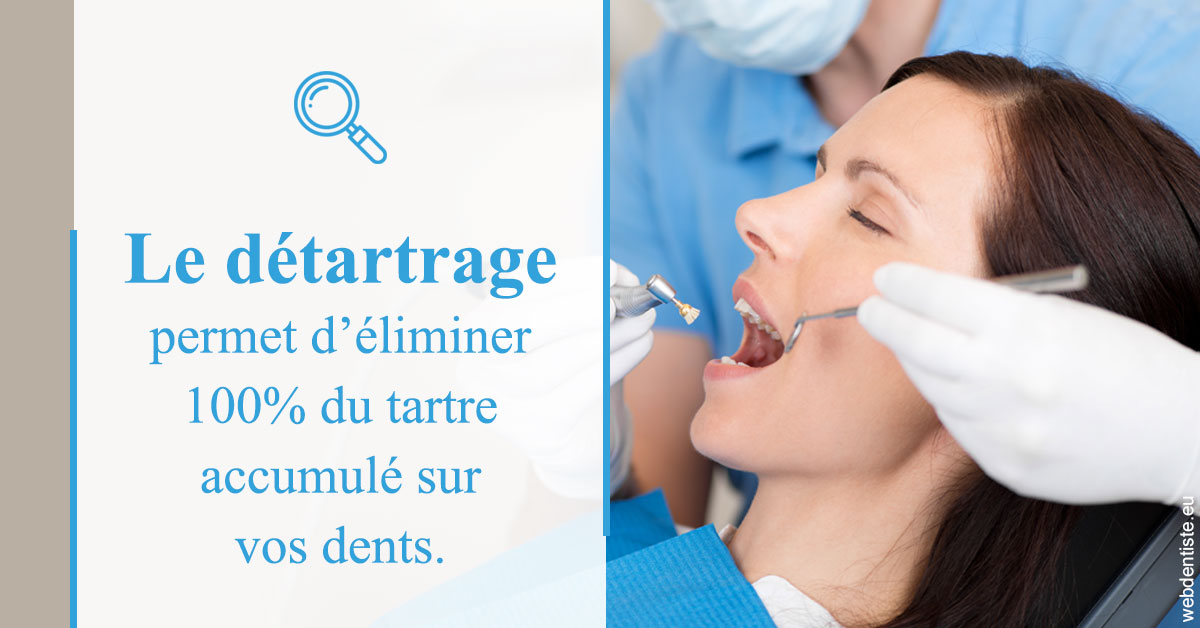 https://www.orthodontiste-vaud-geneve.ch/En quoi consiste le détartrage