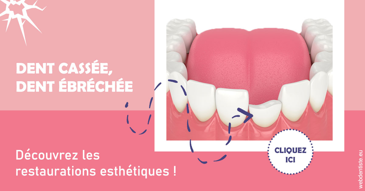 https://www.orthodontiste-vaud-geneve.ch/Dent cassée ébréchée 1