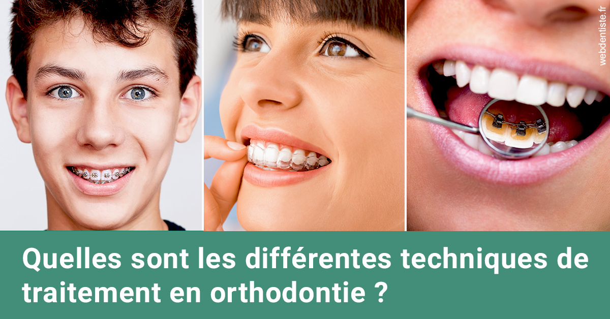 https://www.orthodontiste-vaud-geneve.ch/Les différentes techniques de traitement 2