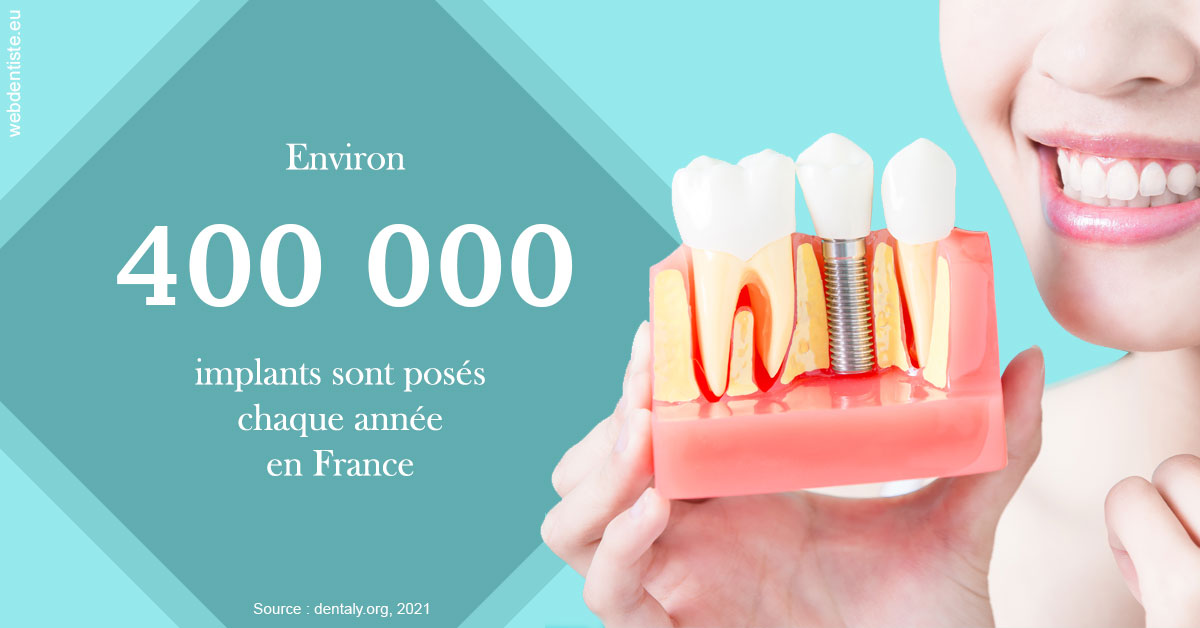 https://www.orthodontiste-vaud-geneve.ch/Pose d'implants en France 2