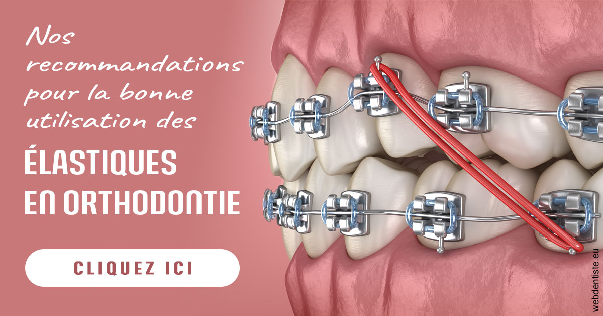 https://www.orthodontiste-vaud-geneve.ch/Elastiques orthodontie 2