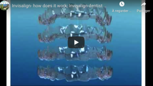 Invisalign- how does it work, Invisalign dentist Sydney 0296591200